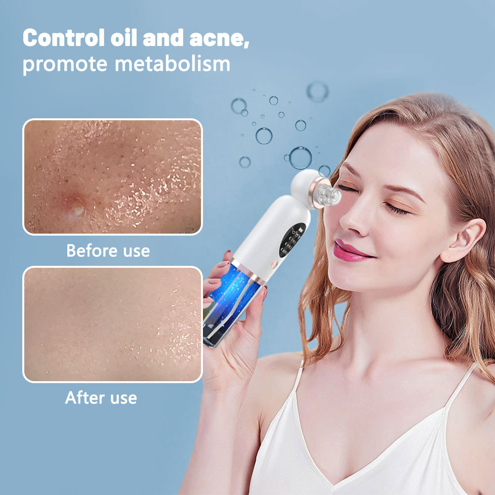 Pore Vacuum - Siyah Nokta Temizleyici Gözenek Vakumlu Yüz