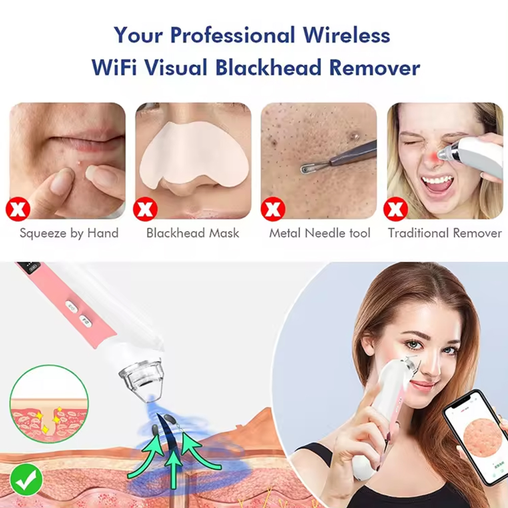 Kamera ile 6 kafaları gözenek  - Pore Vacuum incelemesi ve fiyatı