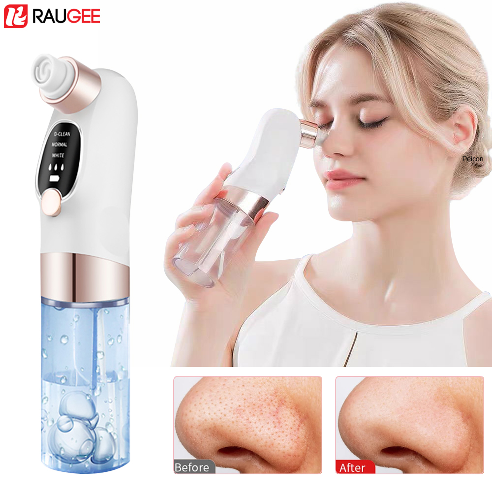 Siyah nokta Remover Elektrikli - Pore Vacuum incelemesi ve fiyatı