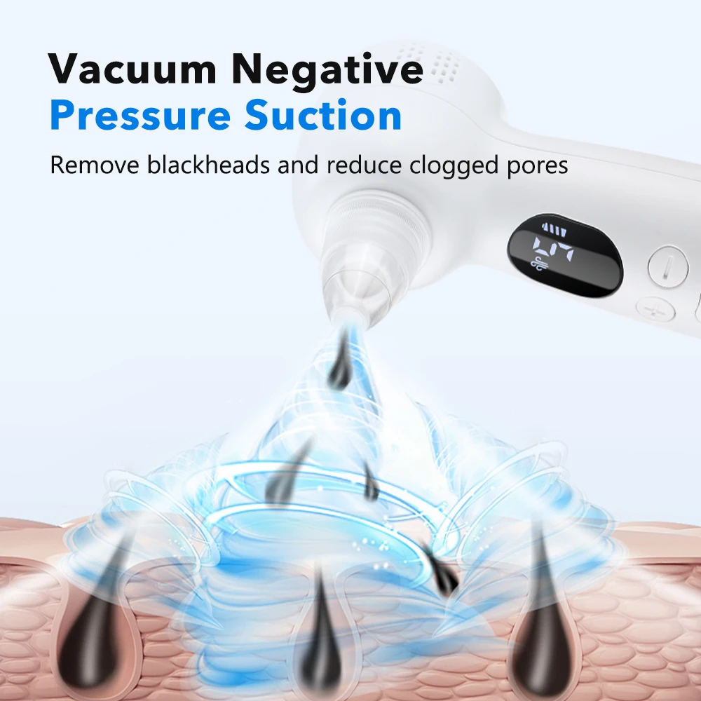 Siyah Nokta Temizleyici Gözene - Pore Vacuum incelemesi ve fiyatı