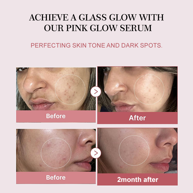 Donuk Ciltler İçin Somon PDRN  - Beauty Full Makeup incelemesi ve fiyatı